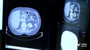 El departamento de salud de Orihuela recibirá maquinaria de radiología digital en columna a suelo